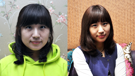 长春瘦脸,长春除皱,长春祛斑,长春隆鼻