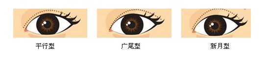双眼皮,类型,长春好的整形医院