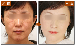 对比图,长春好的整形医院