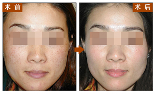 对比图,长春好的整形医院