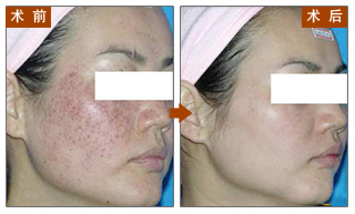 对比图,长春好的整形医院