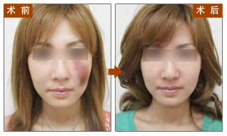 对比图,长春好的整形医院