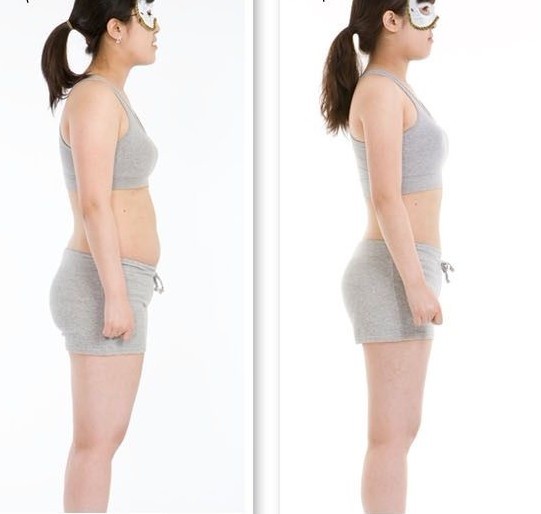 吸脂,对比图,长春好的整形医院